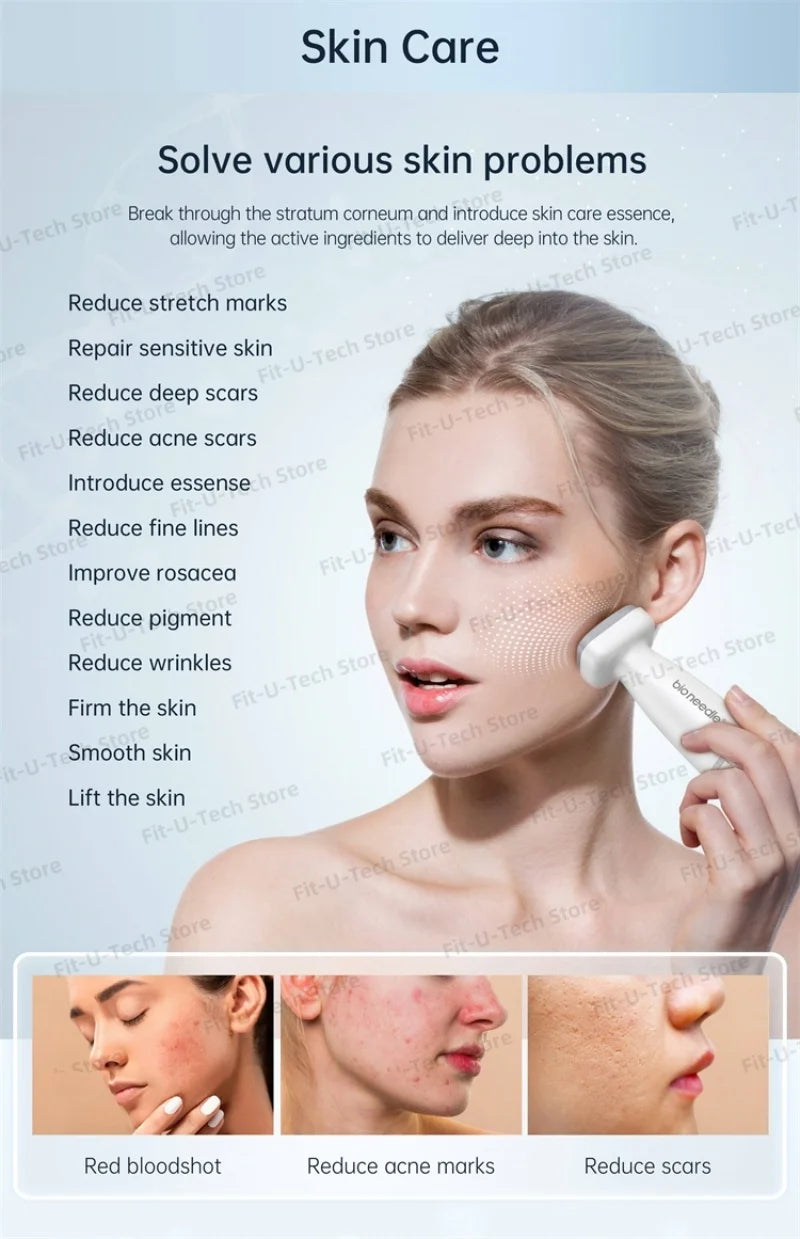 adjustable titanium stamp derma roller face roller beard growth massager scalp massage 120pins microneedling